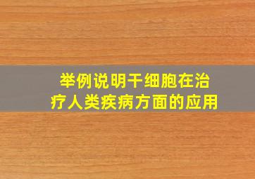 举例说明干细胞在治疗人类疾病方面的应用