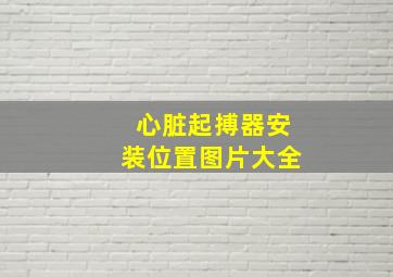 心脏起搏器安装位置图片大全