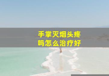 手掌灭烟头疼吗怎么治疗好