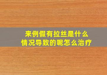 来例假有拉丝是什么情况导致的呢怎么治疗