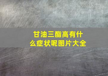 甘油三酯高有什么症状呢图片大全