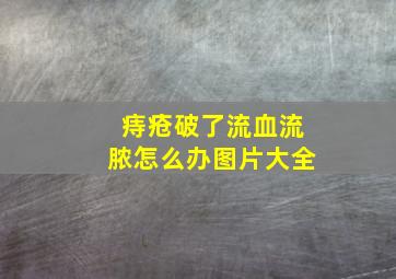 痔疮破了流血流脓怎么办图片大全