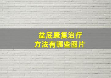 盆底康复治疗方法有哪些图片