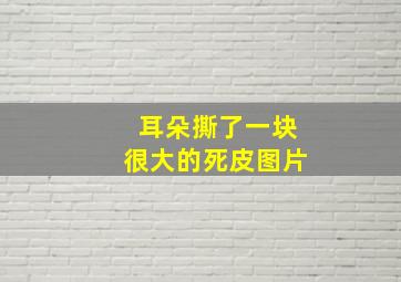 耳朵撕了一块很大的死皮图片