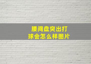 腰间盘突出打球会怎么样图片