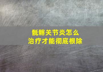 骶髂关节炎怎么治疗才能彻底根除